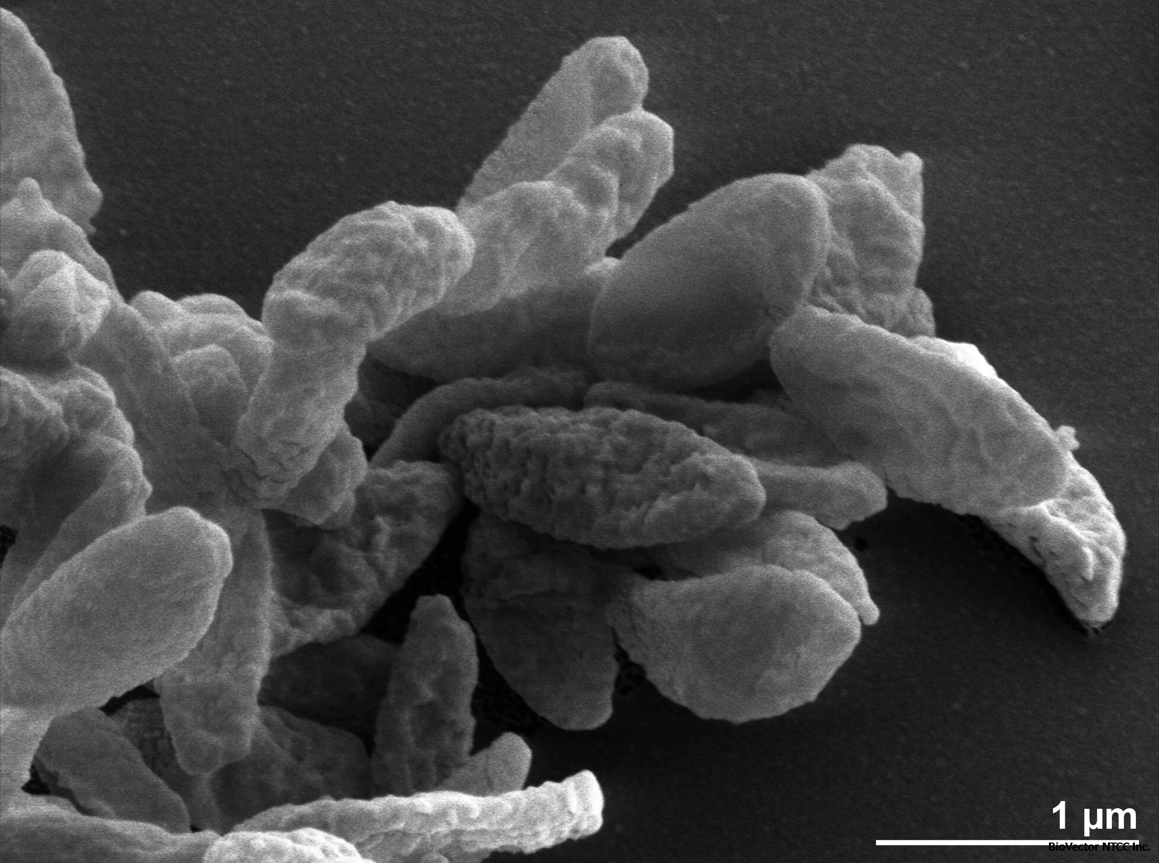 Odoribacter splanchnicus 1651/6 | Type strain | DSM 20712, ATCC 29572, CCUG  21054, CIP 104287, LMG 8202, NCTC 10825, CCUG 21054 A, CCM 6029, JCM 15291  | BacDiveID:12520