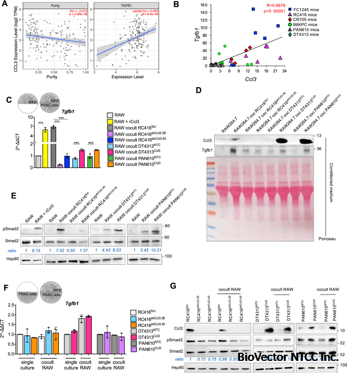 CCL3 predicts exceptional response to TGFβ inhibition in basal-like  pancreatic cancer enriched in LIF-producing macrophages | npj Precision  Oncology