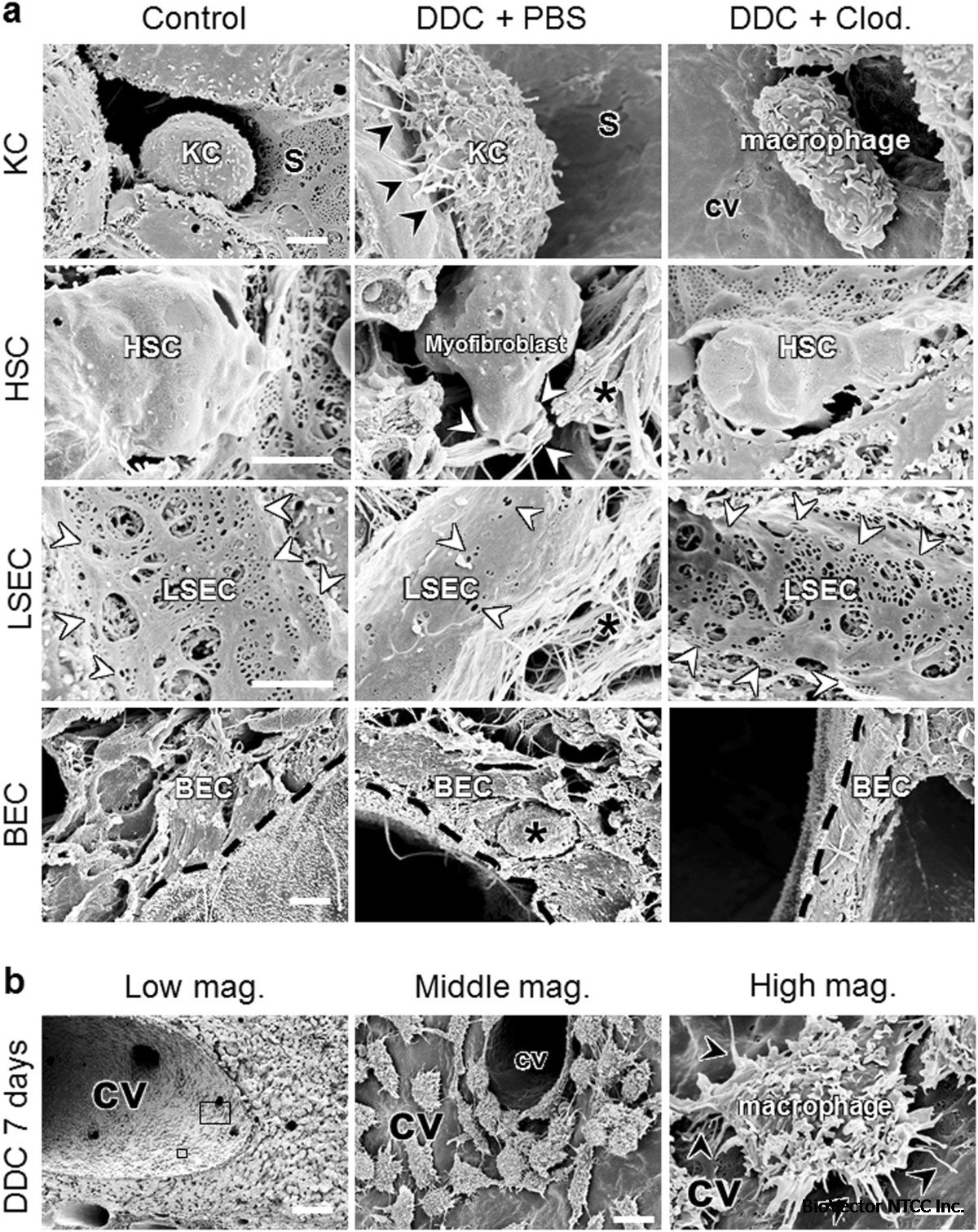 Pivotal roles of Kupffer cells in the progression and regression of  DDC-induced chronic cholangiopathy | Scientific Reports