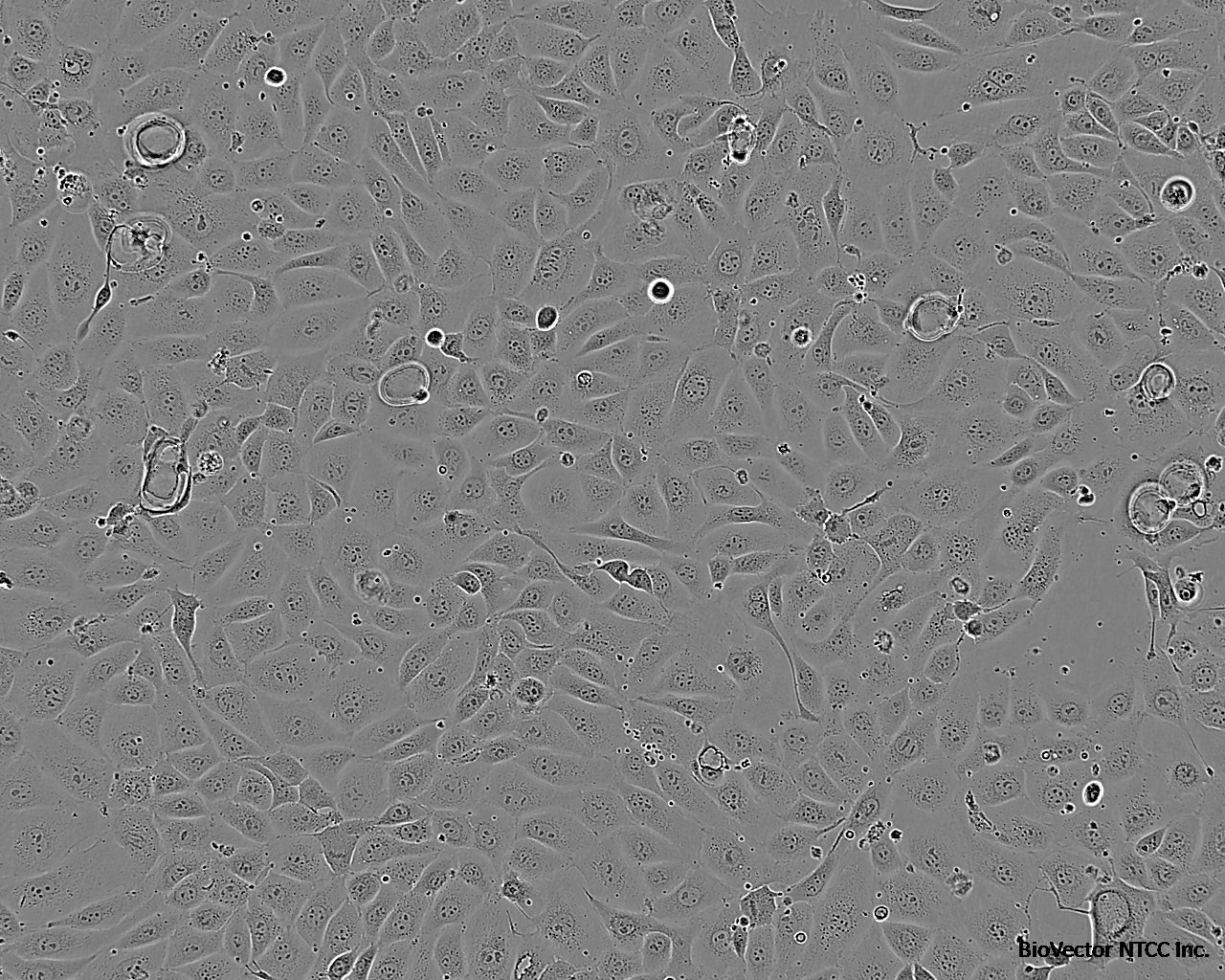 hEM15A Cell:人永生化子宮內(nèi)膜異位癥患者在位內(nèi)膜間質(zhì)細(xì)胞系價(jià)格 1123元/cells 廠家：上海賓穗生物科技有限公司